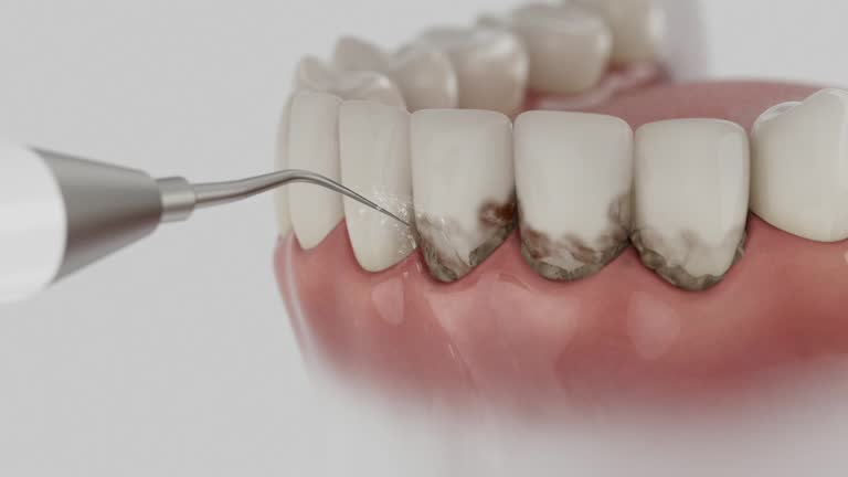 Trusted Teeth Cleaning And Checkup service in Salt Lake City, UT - Dentist Open Now